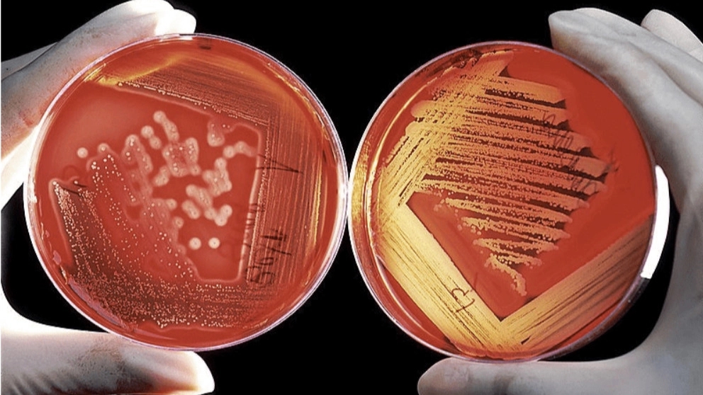 MERCK culture medium MERCK culture medium